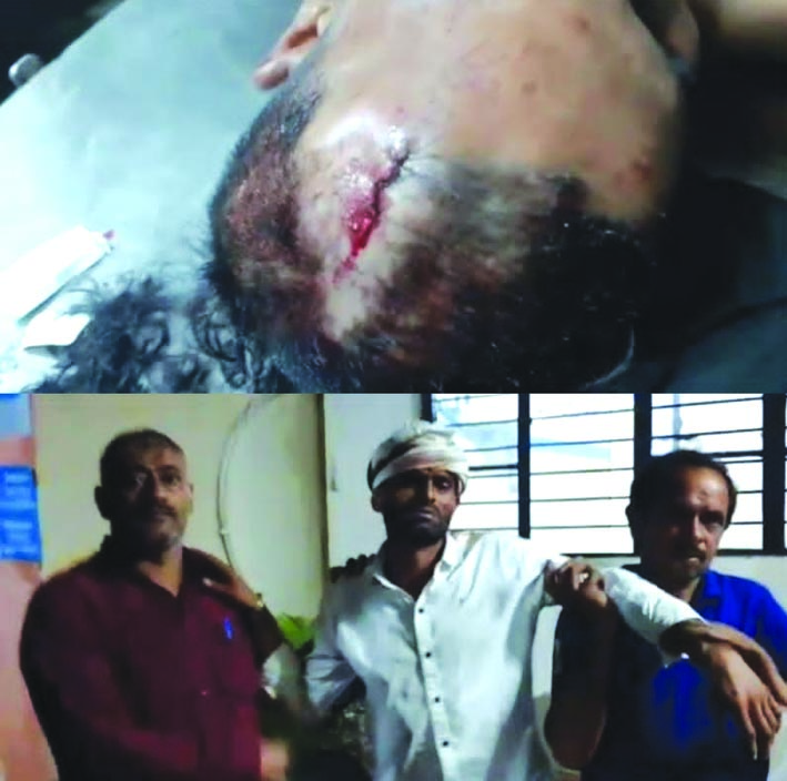 बच्चों में विवाद के बाद बड़ों में चले लाठी डंडे, सात घायल