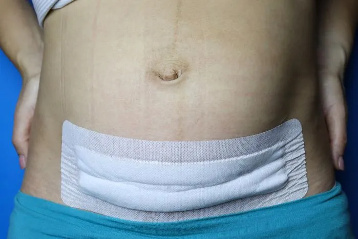 दून के निजी अस्पताल में डिलीवरी के बाद महिला के पेट में छूट गई कॉटन पट्टी, मौत