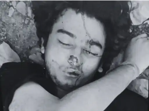 देहरादून के जंगल में मिला युवक का शव:पार्षद ने देखा, पास में पड़े थे इंजेक्शन; पहचान बाकी